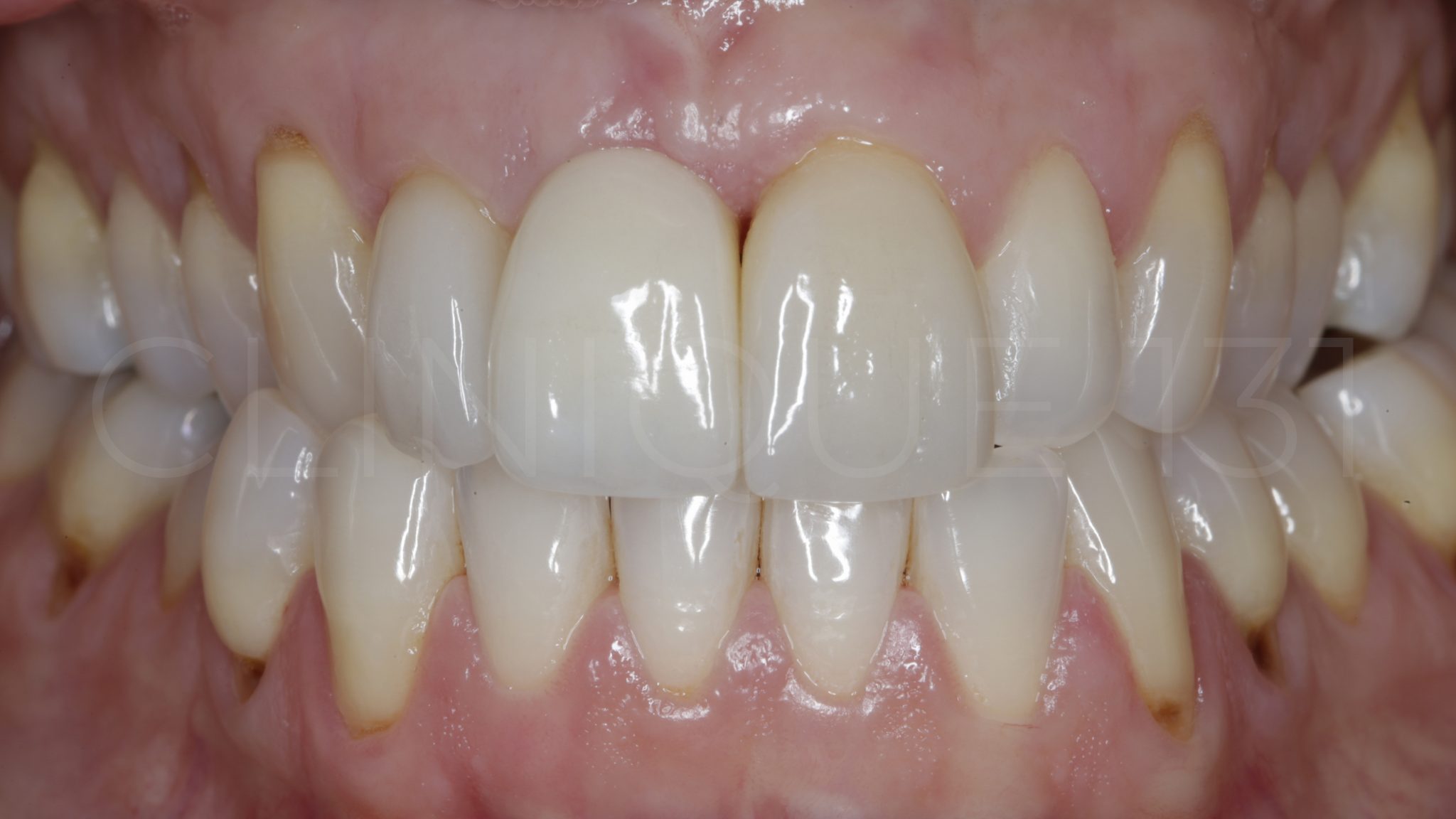 Je souhaite une solution naturelle pour soigner mes dents Clinique 131